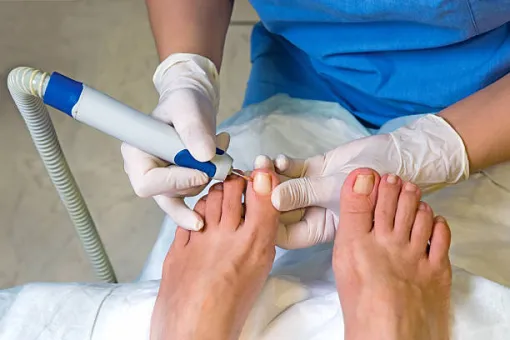Soins d'ongles incarnés de sportifs à Marseille, Marseille, Geraldine Sangiuolo